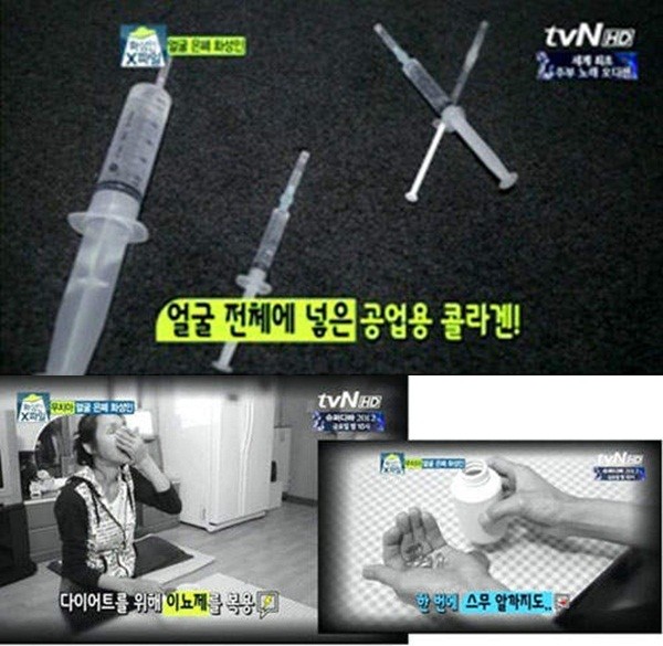Hàn Quốc: Rụng sạch răng vì phẫu thuật thẩm mỹ 7
