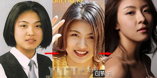 Ha Ji Won bị nghi mới tiêm botox 3