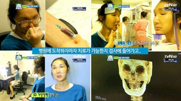 Hàn Quốc: Rụng sạch răng vì phẫu thuật thẩm mỹ 9