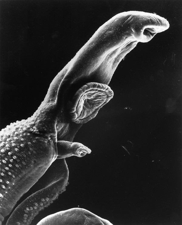 Loài ký sinh trùng sống trong cơ thể người hàng chục năm 2