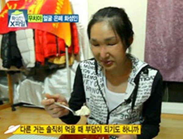 Hàn Quốc: Rụng sạch răng vì phẫu thuật thẩm mỹ 4