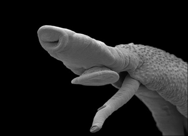 Loài ký sinh trùng sống trong cơ thể người hàng chục năm 1