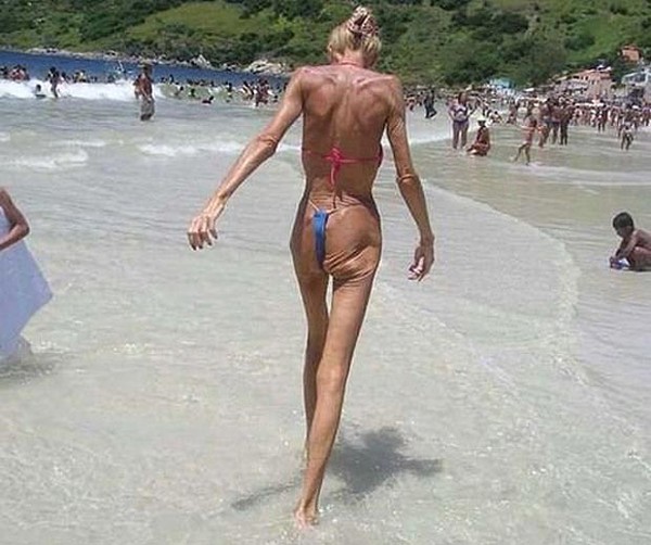 Sốc với những thảm họa... bikini trên bãi biển 8