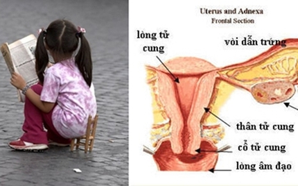 Các bác sĩ đã phẫu thuật và loại bỏ khối u cho cô bé